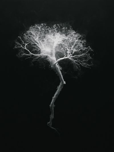 Ghost Tree Black-White Print.