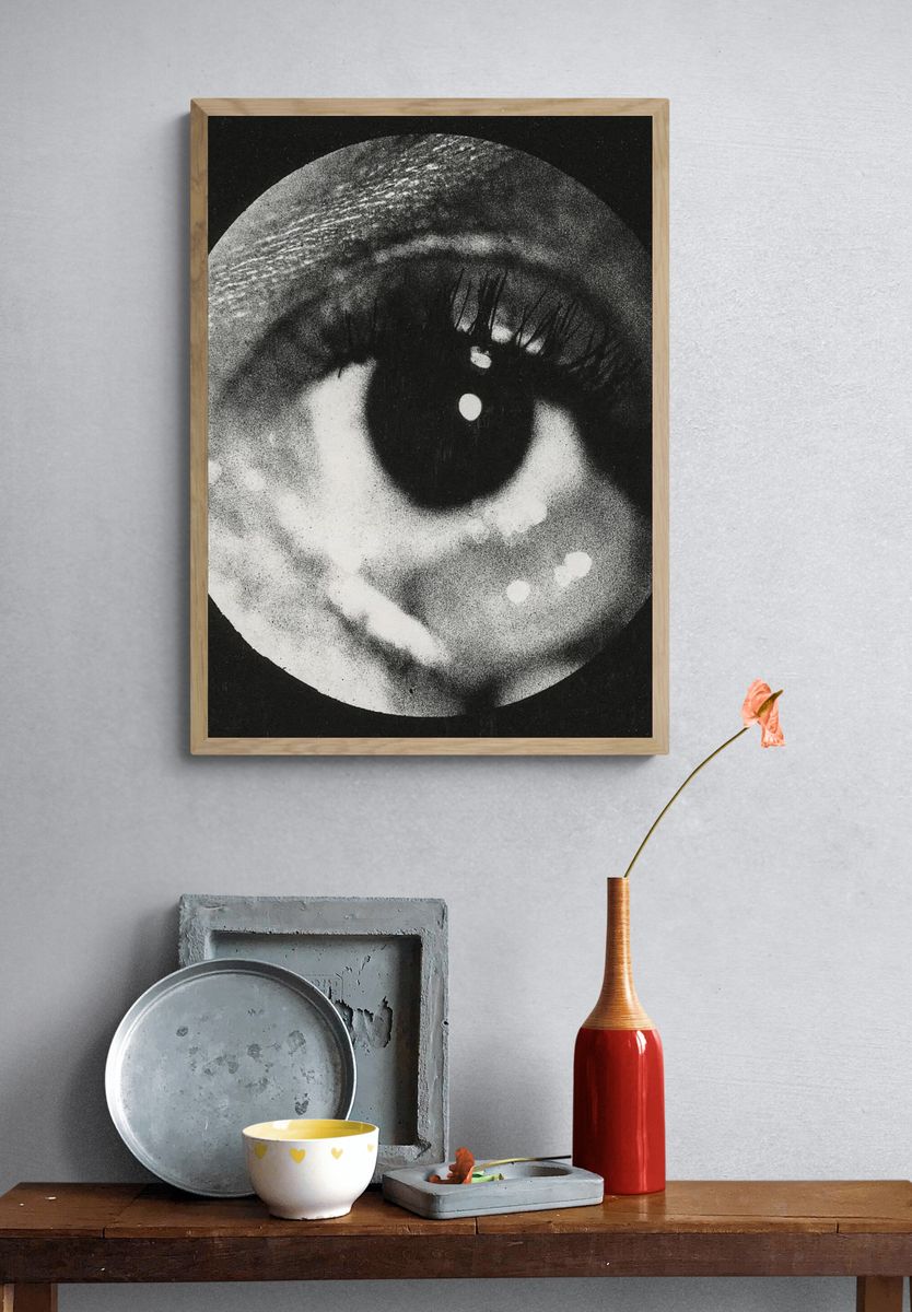 Clinical photograph cyst conjunctiva. Original. — room view 3