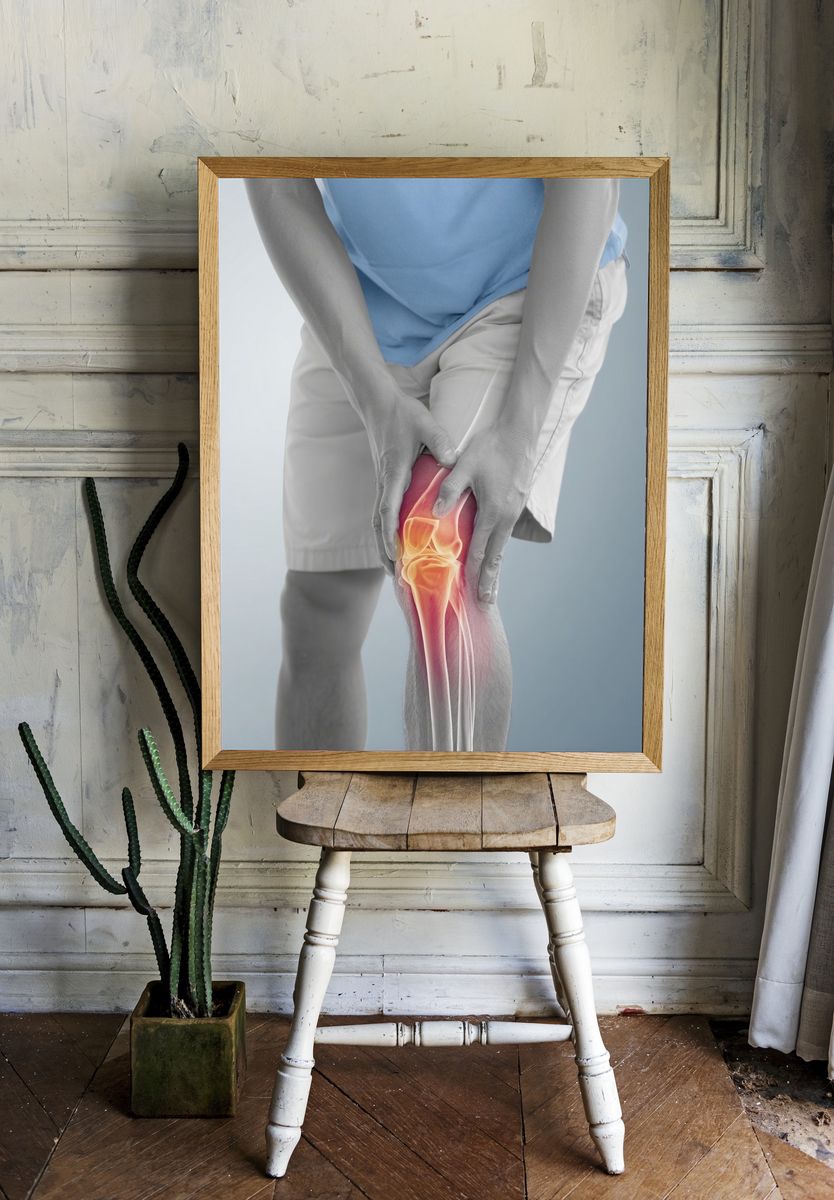 Knee Pain Anatomy Photography Poster. — room view 1