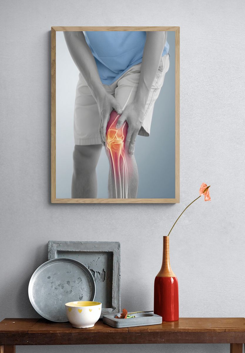 Knee Pain Anatomy Photography Poster. — room view 3