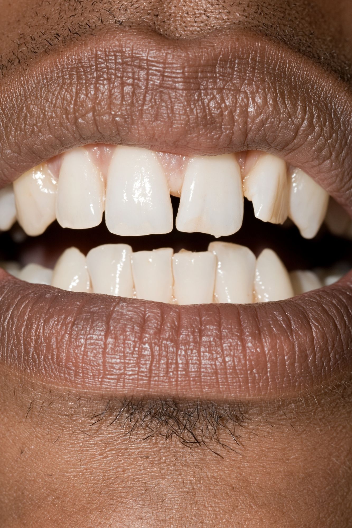 Close-Up Smile Photography Poster. poster — photography art