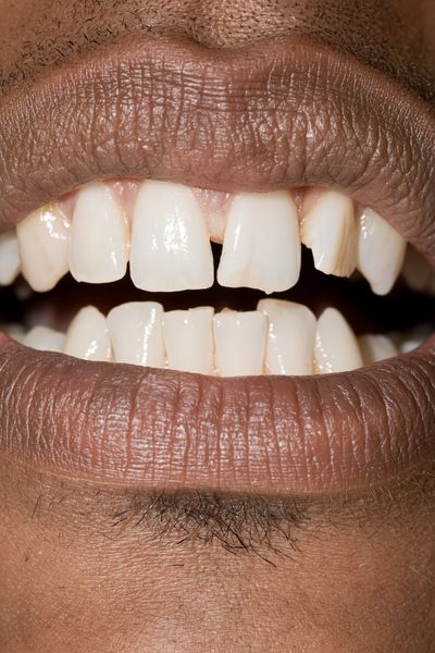 Close-Up Smile Photography Poster. poster