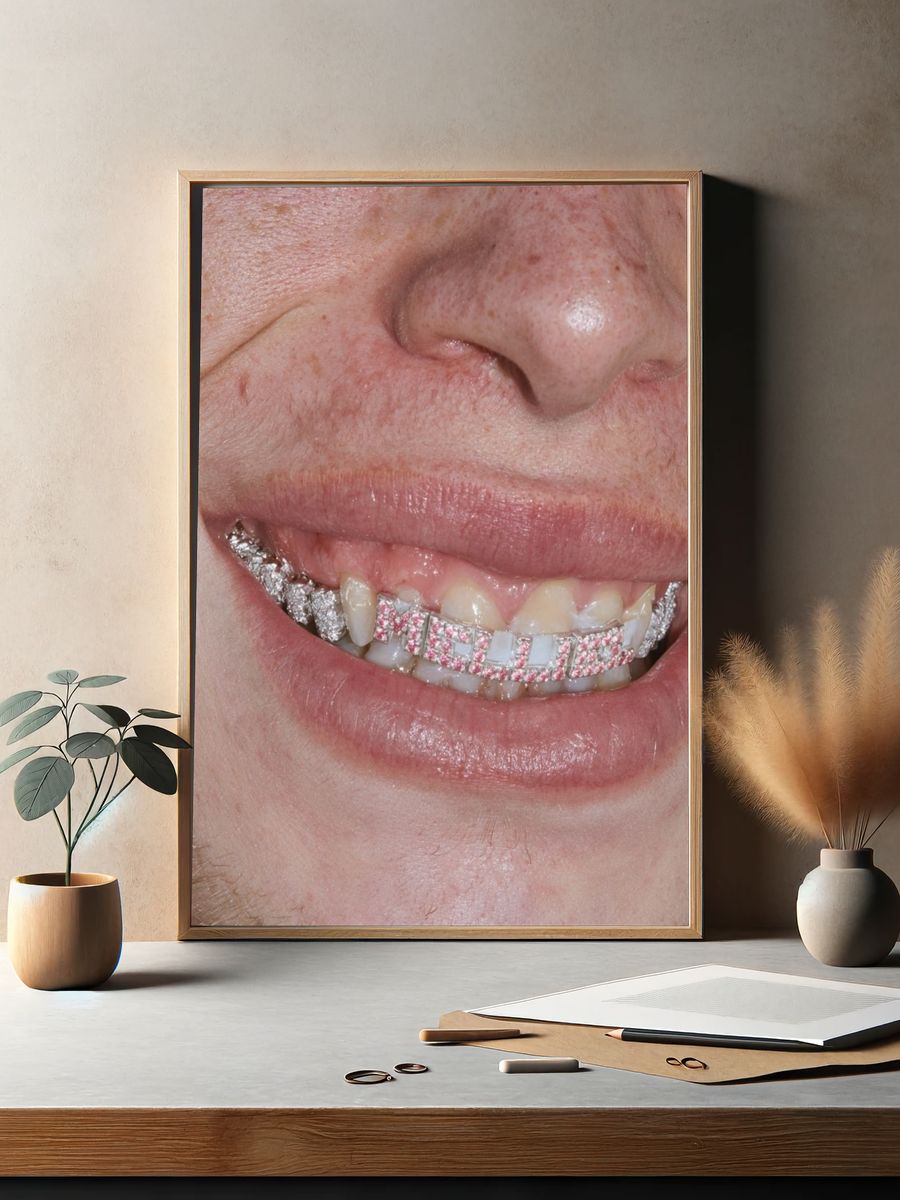 Diamond Grill Smile Photography Poster. — room view 2