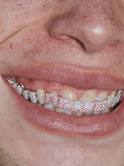 Diamond Grill Smile Photography Poster.