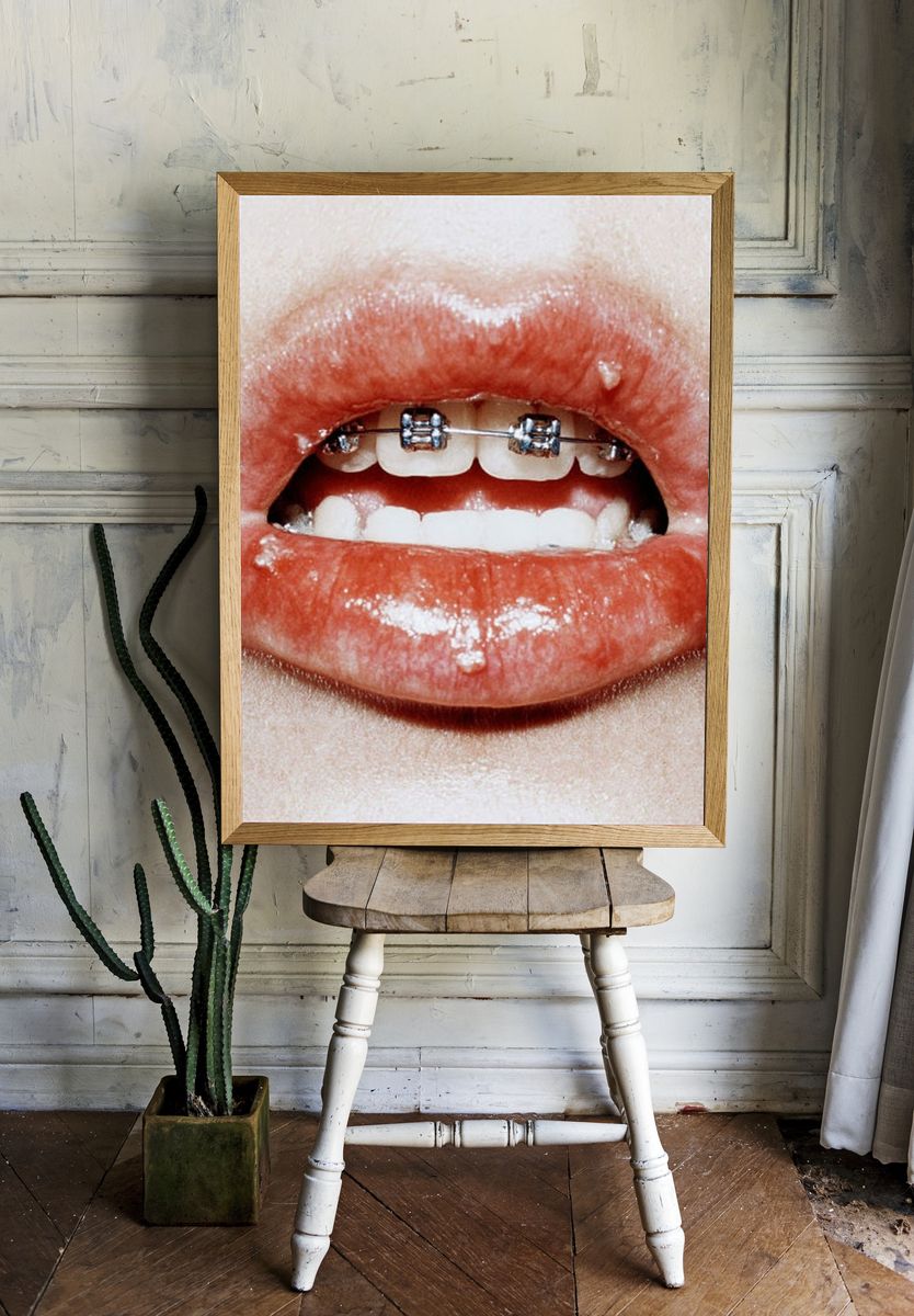 Braces Lips Close-Up Photography Poster. room preview