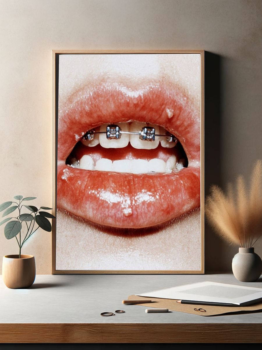 Braces Lips Close-Up Photography Poster. — room view 2