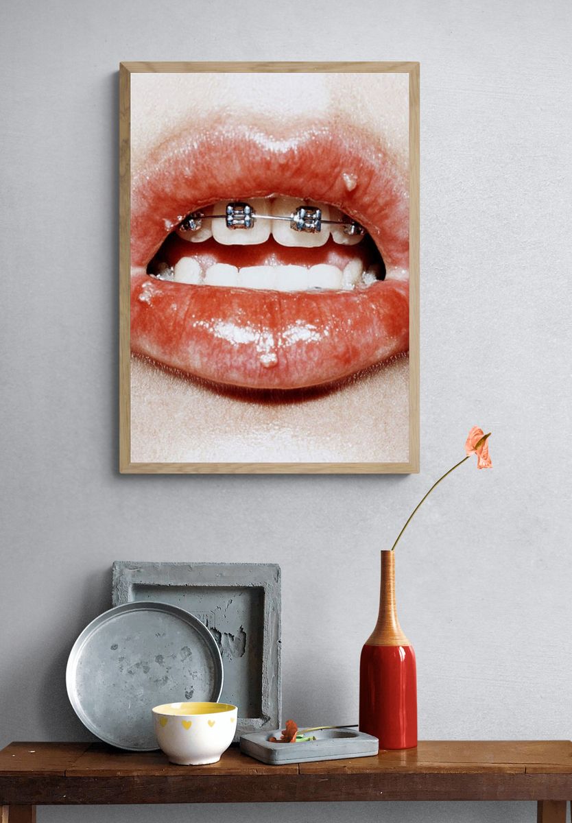 Braces Lips Close-Up Photography Poster. — room view 3