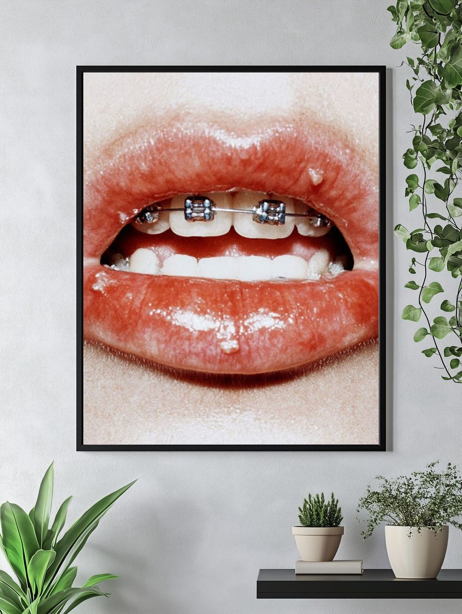 Braces Lips Close-Up Photography Poster. — room view 4