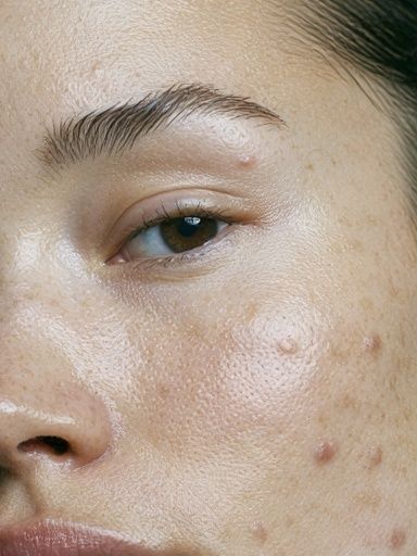 Freckled Face Portrait Print. poster detail