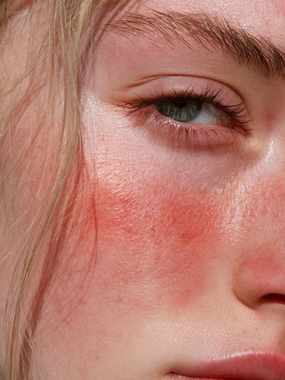 Sunlit Portrait Photography Poster.