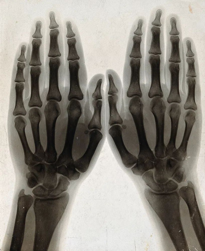 X-Ray Hands Black-White Poster. poster detail