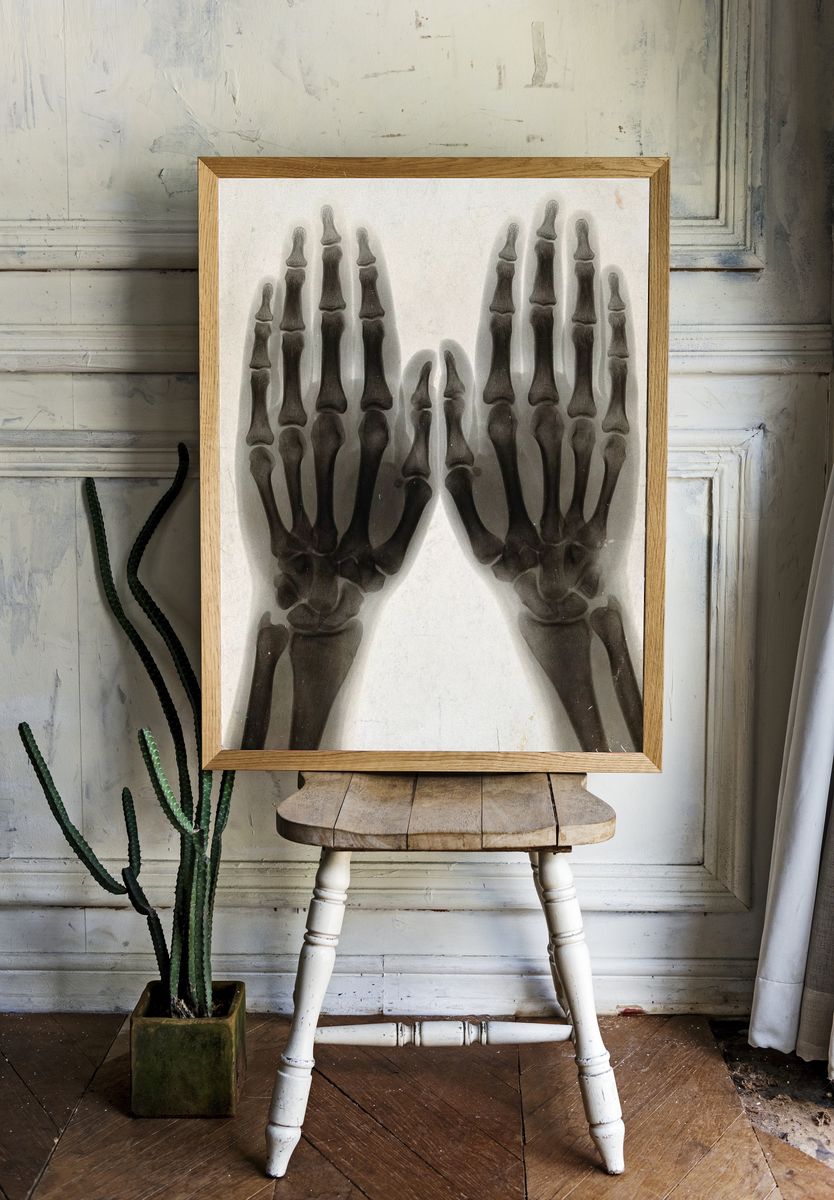 X-Ray Hands Black-White Poster. — room view 1
