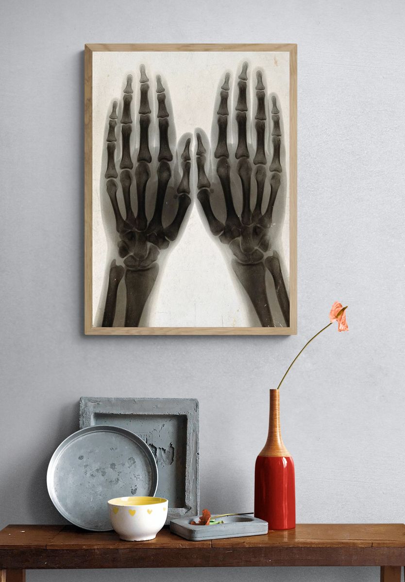 X-Ray Hands Black-White Poster. — room view 3