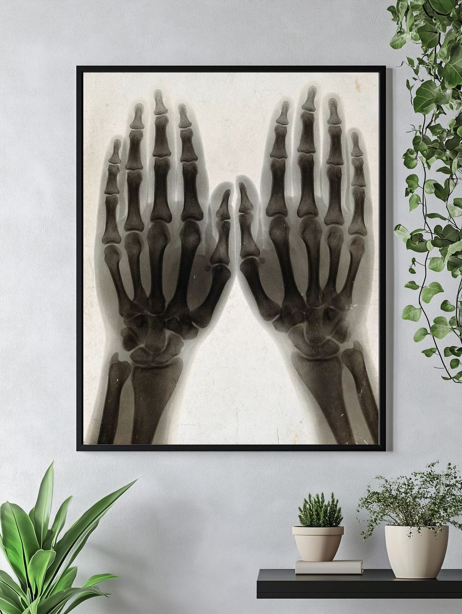 X-Ray Hands Black-White Poster. — room view 4