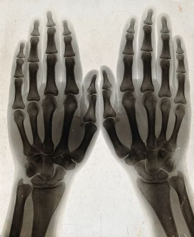 X-Ray Hands Black-White Poster. poster